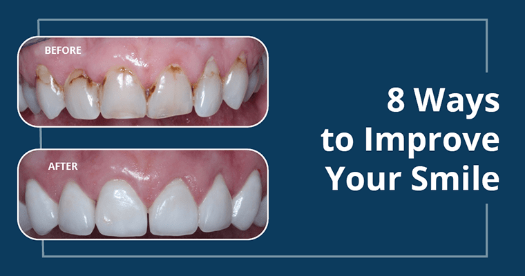 8 Ways to Fix Your Smile, Cosmetic Dentist